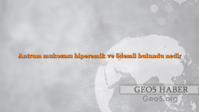 Antrum mukozası hiperemik ve ödemli bulundu nedir